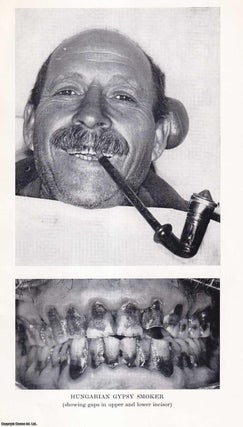 Item #410868 The Teeth of Hungarian Gypsies. An uncommon original article from the Journal of the...